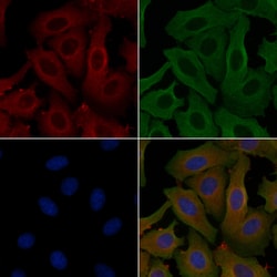 Invitrogen Calpain 11 Polyclonal Antibody 100 &mu;L | Buy Online | Invitrogen&trade; | Fisher Scientific