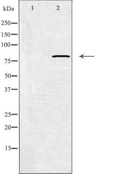 Invitrogen Calpain 11 Polyclonal Antibody 100 &mu;L | Buy Online | Invitrogen&trade; | Fisher Scientific
