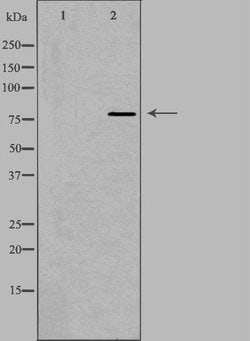Invitrogen Calpain 12 Polyclonal Antibody 100 &mu;L | Buy Online | Invitrogen&trade; | Fisher Scientific