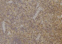 ARPP21 Polyclonal Antibody, Invitrogen 100 &mu;L; Unconjugated:Antibodies,
