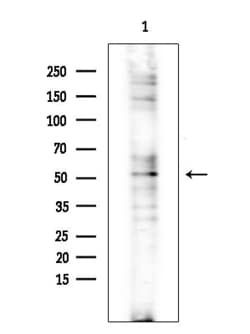 Invitrogen CHST2 Polyclonal Antibody 100 &mu;L; Unconjugated:Antibodies,