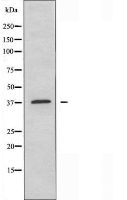 Invitrogen Carbonic Anhydrase III Polyclonal Antibody 100 &mu;L; Unconjugated:Antibodies,