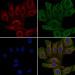 Invitrogen Carbonic Anhydrase VI Polyclonal Antibody 100 &mu;L; Unconjugated:Antibodies,