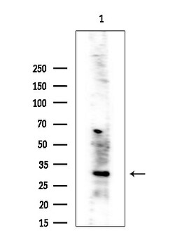 Invitrogen CBR3 Polyclonal Antibody 100 &mu;L | Buy Online | Invitrogen&trade; | Fisher Scientific