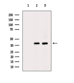 Invitrogen Carboxypeptidase B2 Polyclonal Antibody 100 &mu;L; Unconjugated:Antibodies,