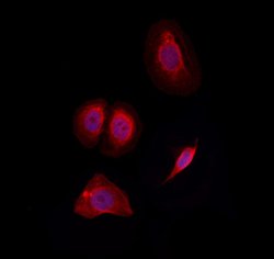 Invitrogen SLC7A4 Polyclonal Antibody 100 &mu;L | Buy Online | Invitrogen&trade; | Fisher Scientific