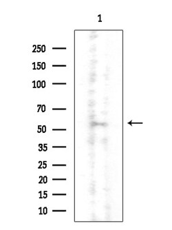Invitrogen CNOT4 Polyclonal Antibody 100 &mu;L | Buy Online | Invitrogen&trade; | Fisher Scientific