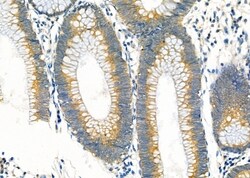 Invitrogen Cdc42EP3 Polyclonal Antibody 100 &mu;L; Unconjugated:Antibodies,