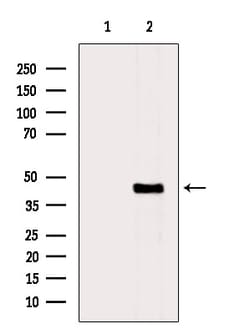 Invitrogen LYAR Polyclonal Antibody 100 &mu;L; Unconjugated:Antibodies,