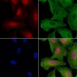 Invitrogen CEP290 Polyclonal Antibody 100 &mu;L; Unconjugated:Antibodies,