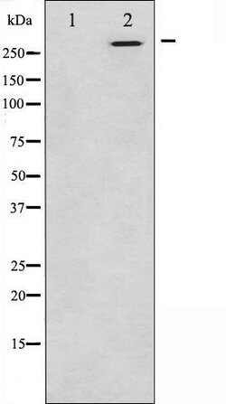Invitrogen CEP290 Polyclonal Antibody 100 &mu;L; Unconjugated:Antibodies,