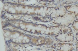 Invitrogen CEP55 Polyclonal Antibody 100 &mu;L; Unconjugated:Antibodies,