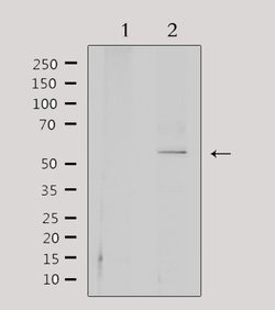 Invitrogen CEP55 Polyclonal Antibody 100 &mu;L; Unconjugated:Antibodies,