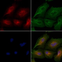 Invitrogen CEP76 Polyclonal Antibody 100 &mu;L; Unconjugated:Antibodies,