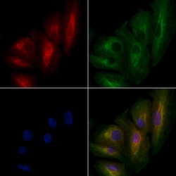 Invitrogen CEP78 Polyclonal Antibody 100 &mu;L; Unconjugated:Antibodies,