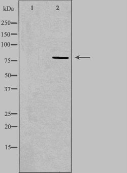 Invitrogen CEP78 Polyclonal Antibody 100 &mu;L; Unconjugated:Antibodies,