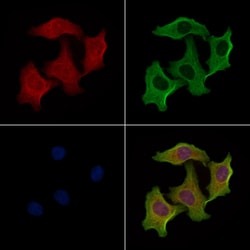 Invitrogen Cerebellin 2 Polyclonal Antibody 100 &mu;L | Buy Online | Invitrogen&trade; | Fisher Scientific