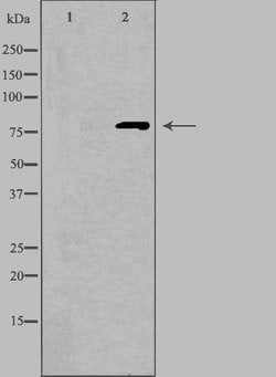 Invitrogen CNGA1 Polyclonal Antibody 100 &mu;L; Unconjugated:Antibodies,