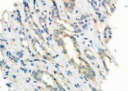 Invitrogen CLCN7 Polyclonal Antibody 100 &mu;L; Unconjugated:Antibodies,
