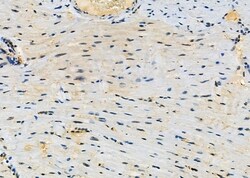 Invitrogen CLCN7 Polyclonal Antibody 100 &mu;L; Unconjugated:Antibodies,