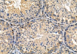Invitrogen CLCN7 Polyclonal Antibody 100 &mu;L; Unconjugated:Antibodies,