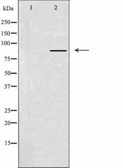 Invitrogen CLCN7 Polyclonal Antibody 100 &mu;L; Unconjugated:Antibodies,