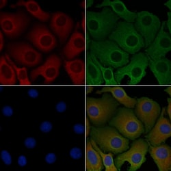 Invitrogen CMTM3 Polyclonal Antibody 100 &mu;L; Unconjugated:Antibodies,