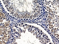 Invitrogen CMTM3 Polyclonal Antibody 100 &mu;L; Unconjugated:Antibodies,