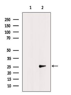 Invitrogen CMTM6 Polyclonal Antibody 100 &mu;L | Buy Online | Invitrogen&trade; | Fisher Scientific