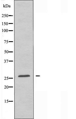 Invitrogen Claudin 6 Polyclonal Antibody 100 &mu;L | Buy Online | Invitrogen&trade; | Fisher Scientific