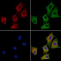 Invitrogen CEP95 Polyclonal Antibody 100 &mu;L; Unconjugated:Antibodies,