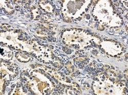 Invitrogen C1QL2 Polyclonal Antibody 100 &mu;L; Unconjugated:Antibodies,