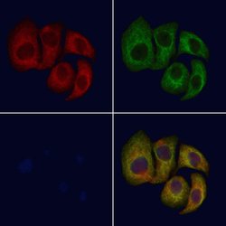 Invitrogen CNGB1 Polyclonal Antibody 100 &mu;L; Unconjugated:Antibodies,