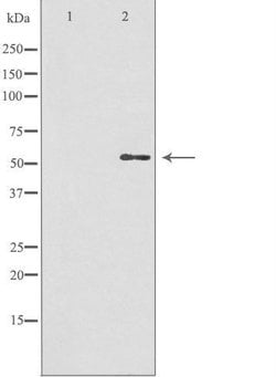 Invitrogen GBA3 Polyclonal Antibody 100 &mu;L; Unconjugated:Antibodies,