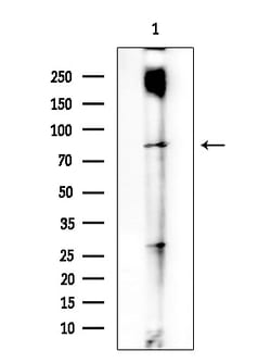 Invitrogen CCP2 Polyclonal Antibody 100 &mu;L; Unconjugated:Antibodies,