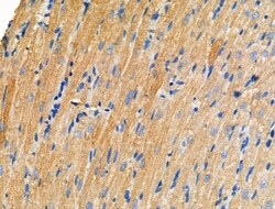 Invitrogen DOCK1 Polyclonal Antibody 100 &mu;L; Unconjugated:Antibodies,