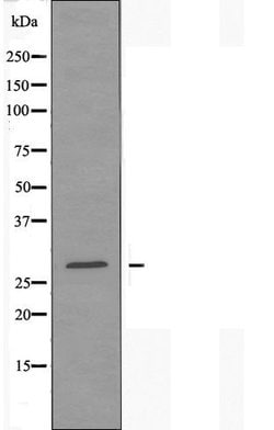 Invitrogen DHRS2 Polyclonal Antibody 100 &mu;L | Buy Online | Invitrogen&trade; | Fisher Scientific