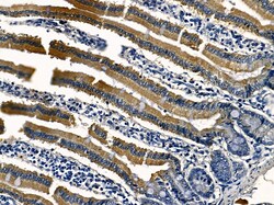 DHPS Polyclonal Antibody:Antibodies, Polyclonal