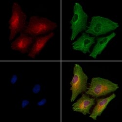 Invitrogen CRMP3 Polyclonal Antibody 100 &mu;L | Buy Online | Invitrogen&trade; | Fisher Scientific