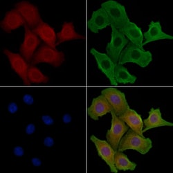 Invitrogen GNPAT Polyclonal Antibody 100 &mu;L; Unconjugated:Antibodies,