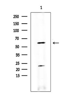 Invitrogen TdT Polyclonal Antibody 100 &mu;L; Unconjugated:Antibodies,