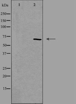 TESK1 Polyclonal Antibody:Antibodies, Polyclonal