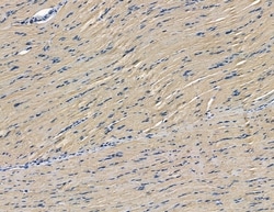 Invitrogen DZIP3 Polyclonal Antibody 100 &mu;L; Unconjugated:Antibodies,