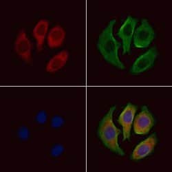 Invitrogen RNF138 Polyclonal Antibody 100 &mu;L; Unconjugated:Antibodies,