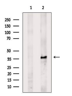 Invitrogen ELOVL4 Polyclonal Antibody 100 &mu;L; Unconjugated:Antibodies,