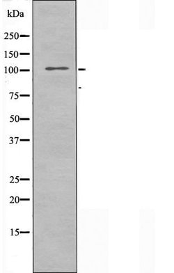 Invitrogen EphA10 Polyclonal Antibody 100 &mu;L; Unconjugated:Antibodies,