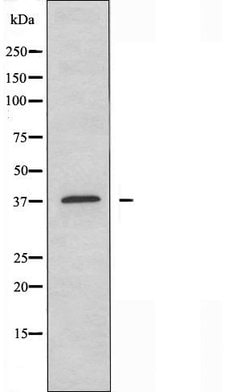 Invitrogen eIF3f Polyclonal Antibody 100 &mu;L; Unconjugated:Antibodies,