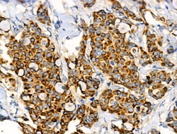 Invitrogen Folate Receptor alpha Polyclonal Antibody 100 &mu;L; Unconjugated:Antibodies,