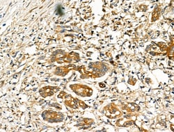 Invitrogen Folate Receptor alpha Polyclonal Antibody 100 &mu;L; Unconjugated:Antibodies,