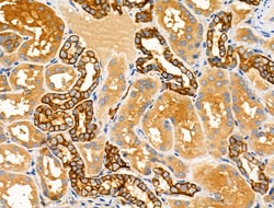 Invitrogen Folate Receptor alpha Polyclonal Antibody 100 &mu;L; Unconjugated:Antibodies,